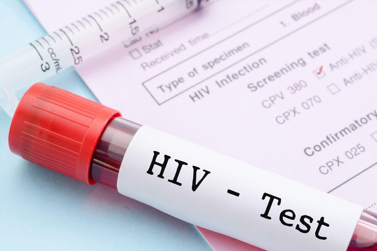 HIV/AIDS Response
